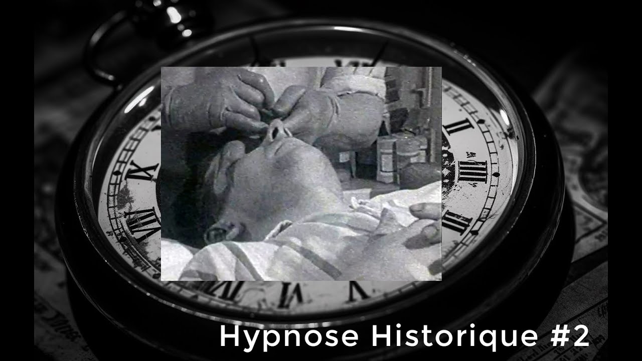 Extrait de chirurgie réalisée en hypno anesthésie par le Dr Jack Gibson à la fin des années 1960