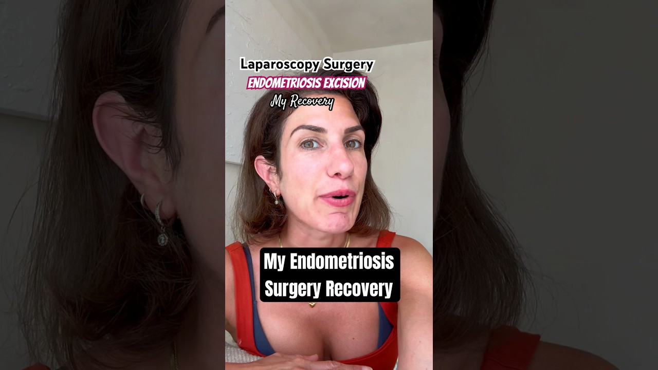 Endometriosis Laparoscopic Excision Surgery. My Recovery Journey #endometriosis #laparoscopysurgery