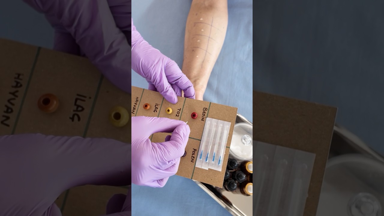 Alerji Testi💉#asmr #asmrcommunityasmr #asmrrelax #asmrtriggers #asmrvideo  #t&uuml;rk&ccedil;easmr  #asmrsound