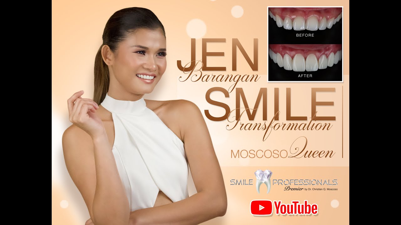 Ms Jen Barangan Smile transformation vlog