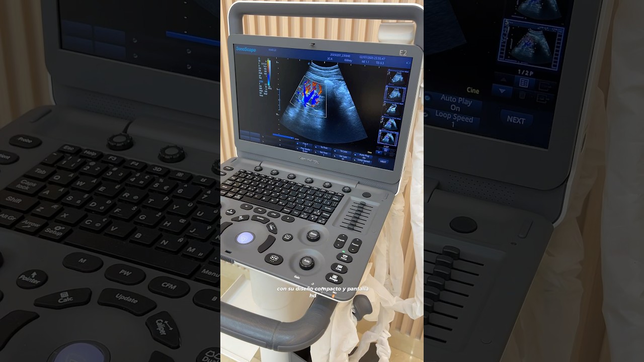 SonoScape Sonografo E2 Pro. Disponible en TecnoMed Caribbean #tecnolog&iacute;am&eacute;dica #tecnologia #tecnomed