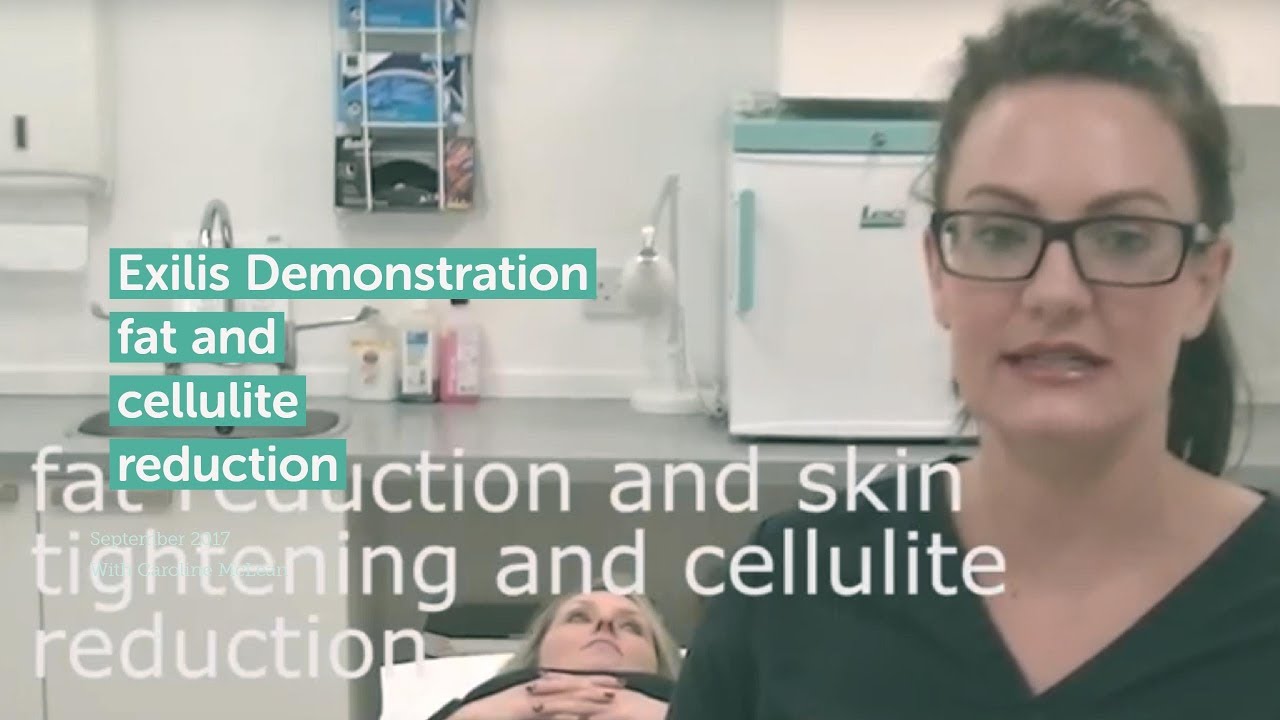 Exilis Elite Treatment at La Belle Forme