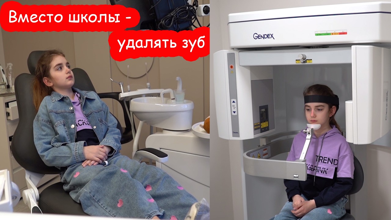 VLOG Удаление зуба прошло очень тяжело