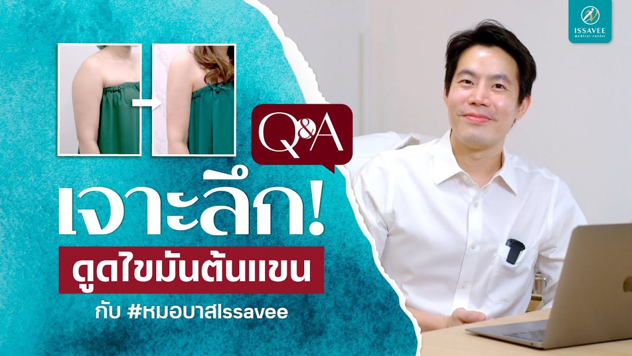 เจาะลึก ดูดไขมันต้นแขน คืออะไร? เหมาะกับใคร? พร้อมตัวอย่างเคส