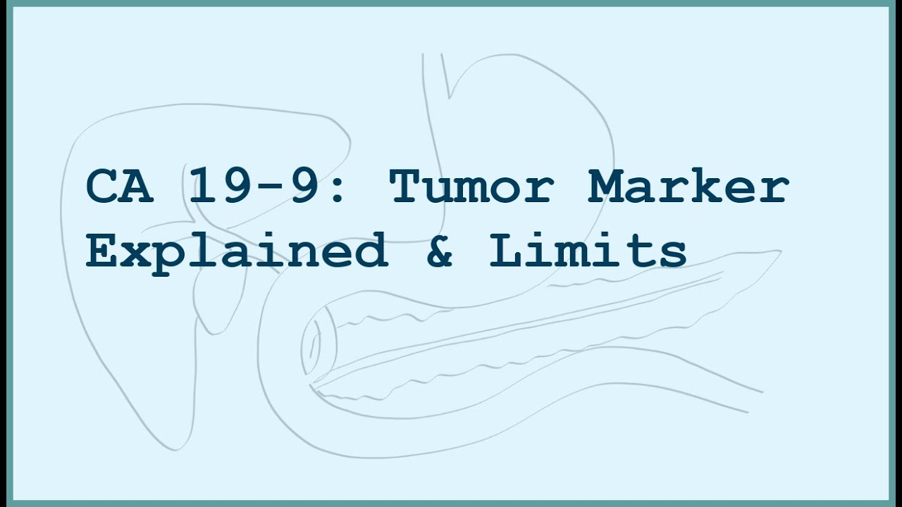 The CA 19-9 Tumor Marker: What it Means in Pancreatic Cancer