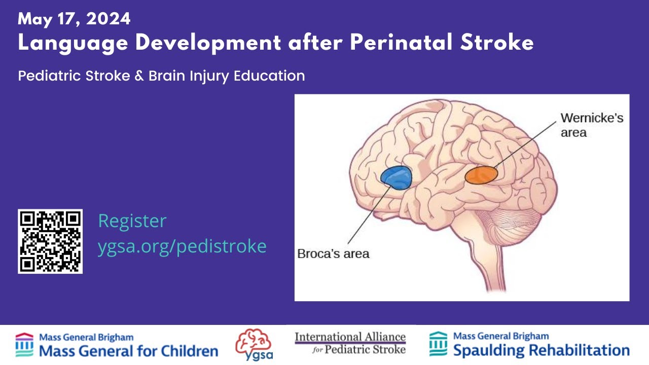 Language Development after Perinatal Stroke