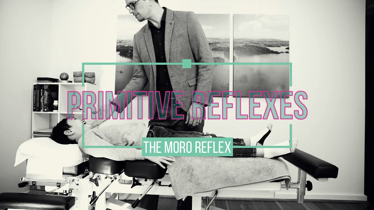 Testing for a Persistent MORO reflex (Moro Test, Crossover Balancing, Pigeon/Duck Walk)