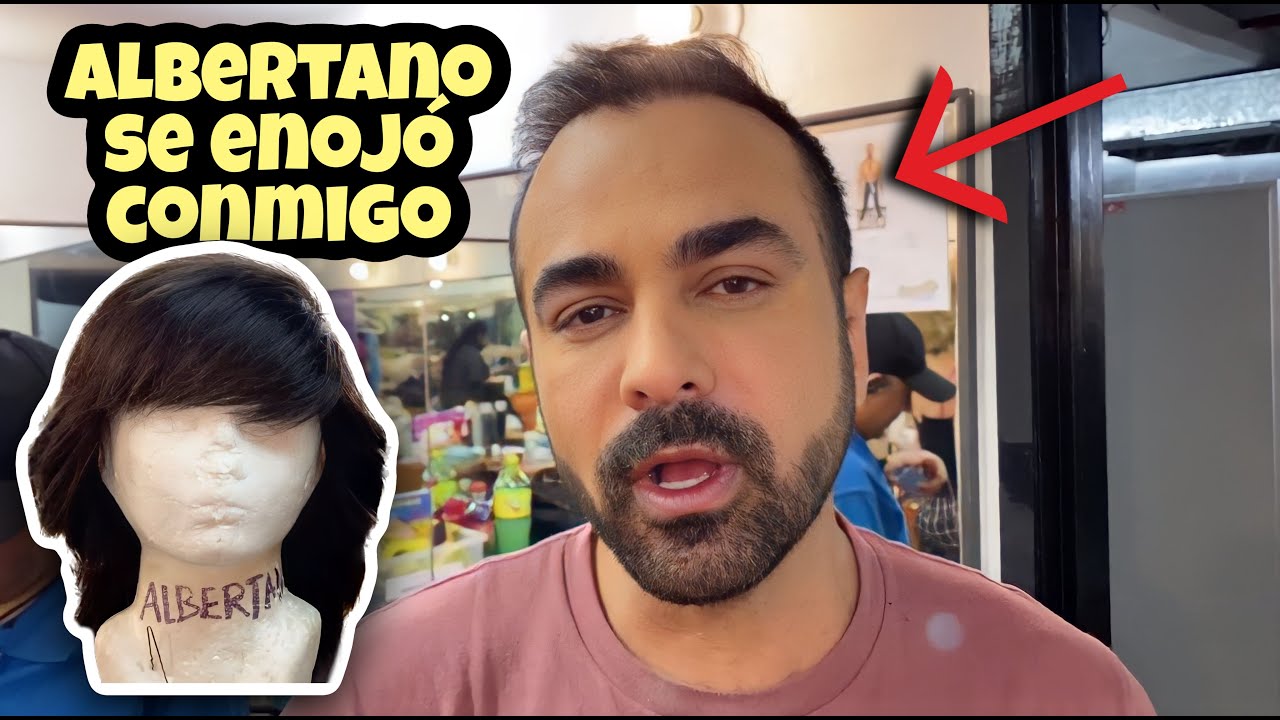 Albertano se en0jó conmigo el día que se le cayó su peluca, esto fue lo que pasó