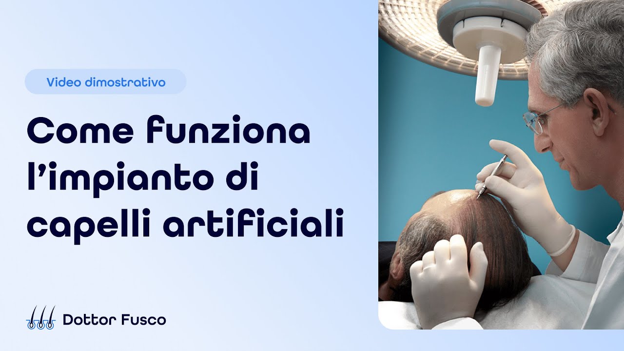 Come funziona l'impianto di capelli artificiali