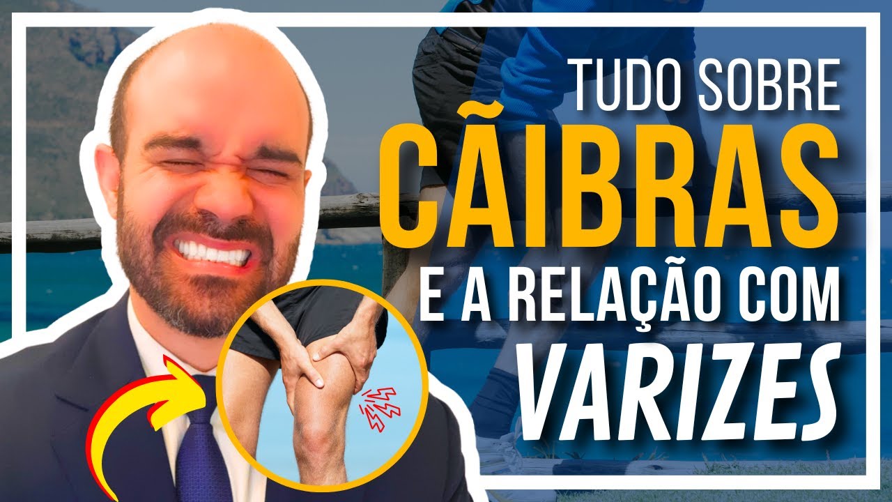 🔴 Tudo sobre CÃIBRAS [Varizes pode ser a causa??] #vidasemvarizes