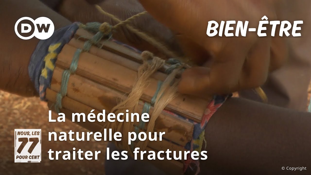 Au Cameroun, une technique traditionnelle pour traiter les fractures osseuses