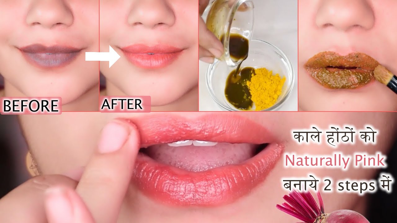In 3 Uses - Black Pigmented Lips to Naturally Pink💋 Lips Guaranteed-काले होठों को गुलाबी कैसे बनाये