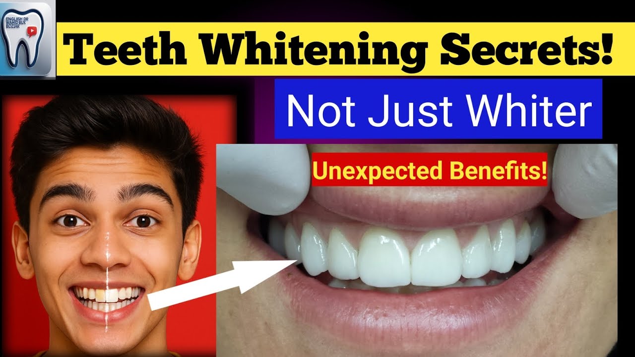 #1 Teeth Cleaning At Home | Teeth Saaf Karne Ka Tarika | Tartar Removal|Teeth Whitening At Dentist