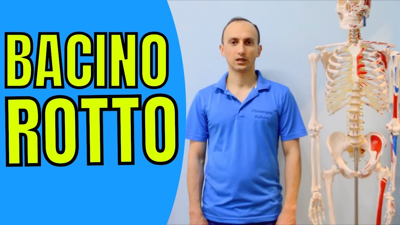 Frattura del Bacino: come si Manifesta e Come Recuperare
