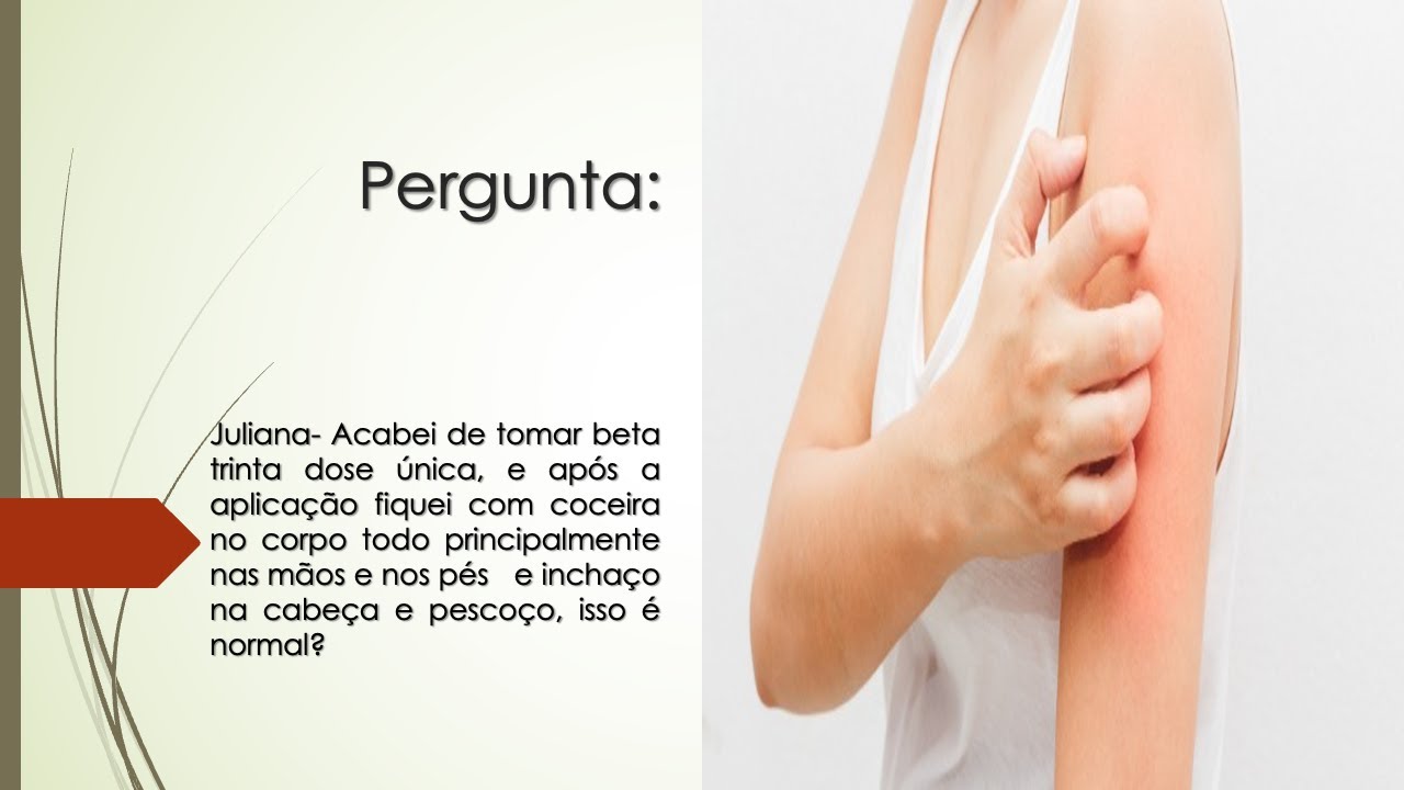 Tomei Beta Trinta e fiquei com coceira no corpo todo e incha&ccedil;o na cabe&ccedil;a e pesco&ccedil;o | Isso &eacute; normal?