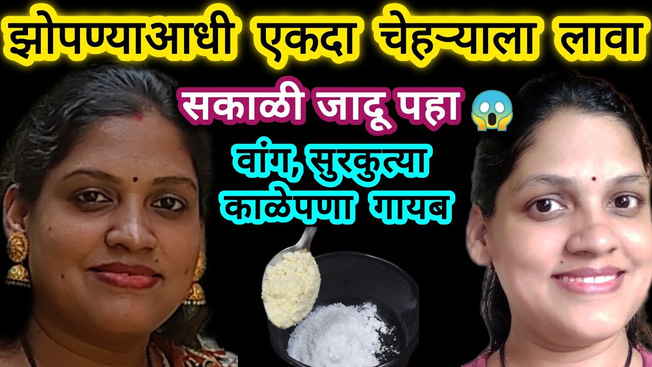 वांग, काळे डाग, सुरकुत्या कायमच्या जातील या उपायाने ✨ चेहरा होईल गोरा vang Chehra gora Kitchen tips 