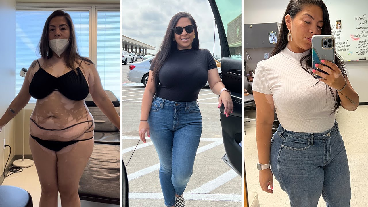 Nubia's Body Transformation: Getting a tummy tuck alternative AbEX and reviewing Sono Bello Houston