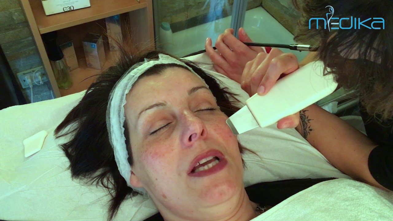 Peeling cavitation - Medika Italia