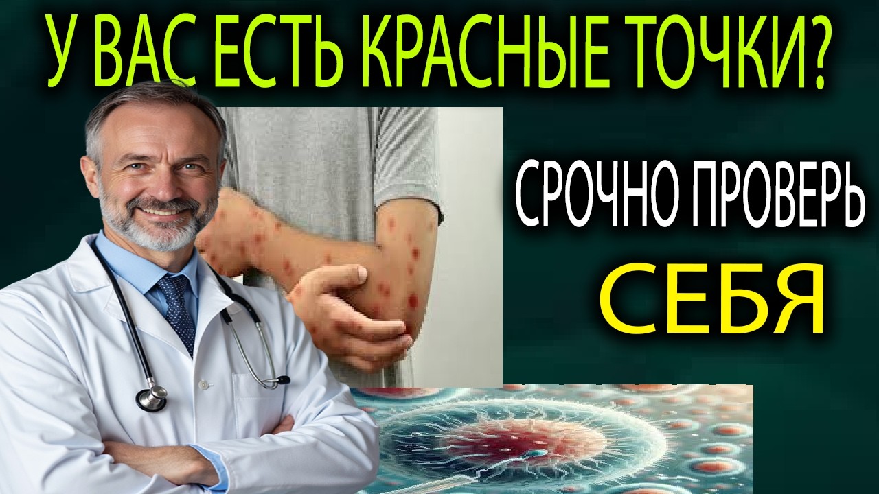 КРАСНЫЕ ТОЧКИ НА ТЕЛЕ — это ОПУХОЛЬ или МИФ про “печень”? Вся правда о гемангиоме!