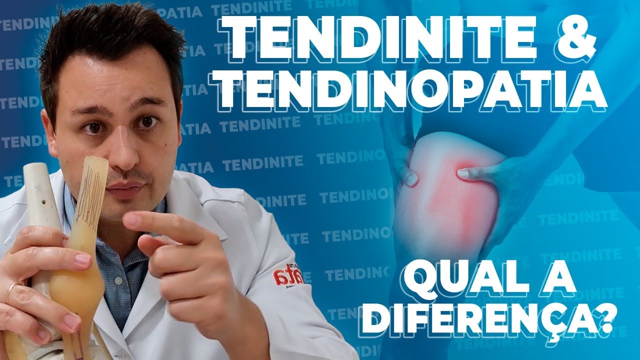 Tendinite e Tendinopatia