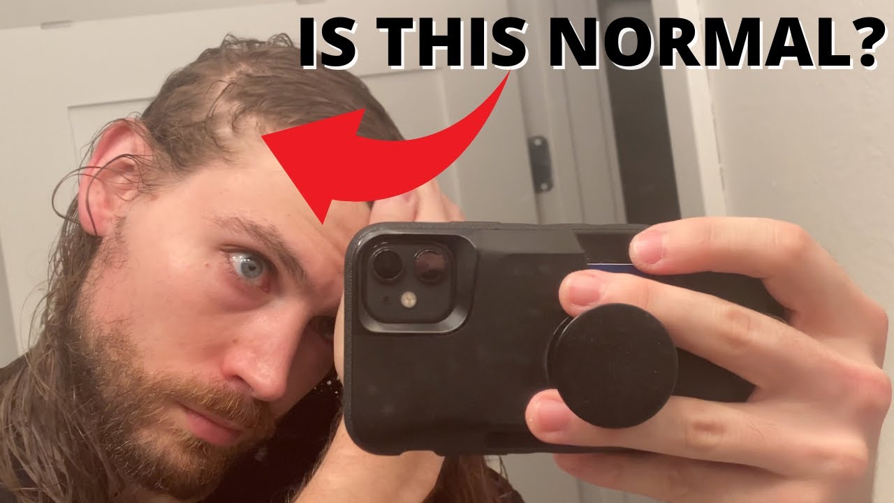 5 NORMAL Things Your Hair Does That You FREAK OUT About