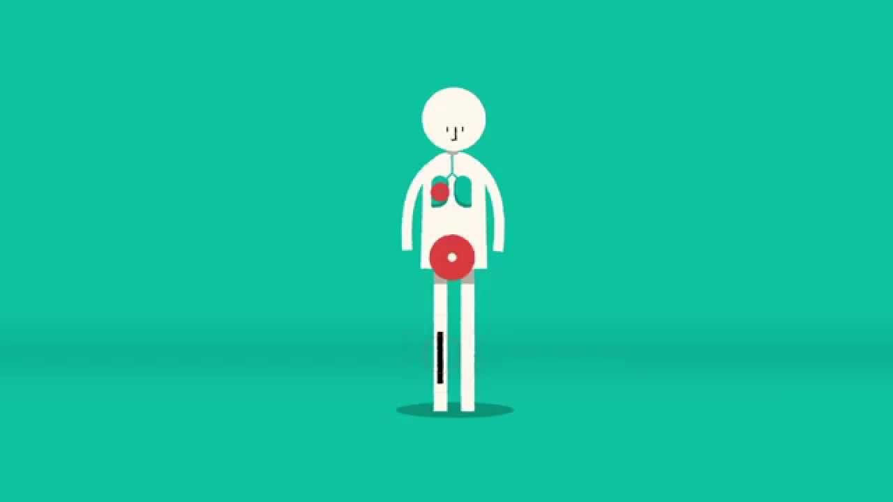 What is sepsis?