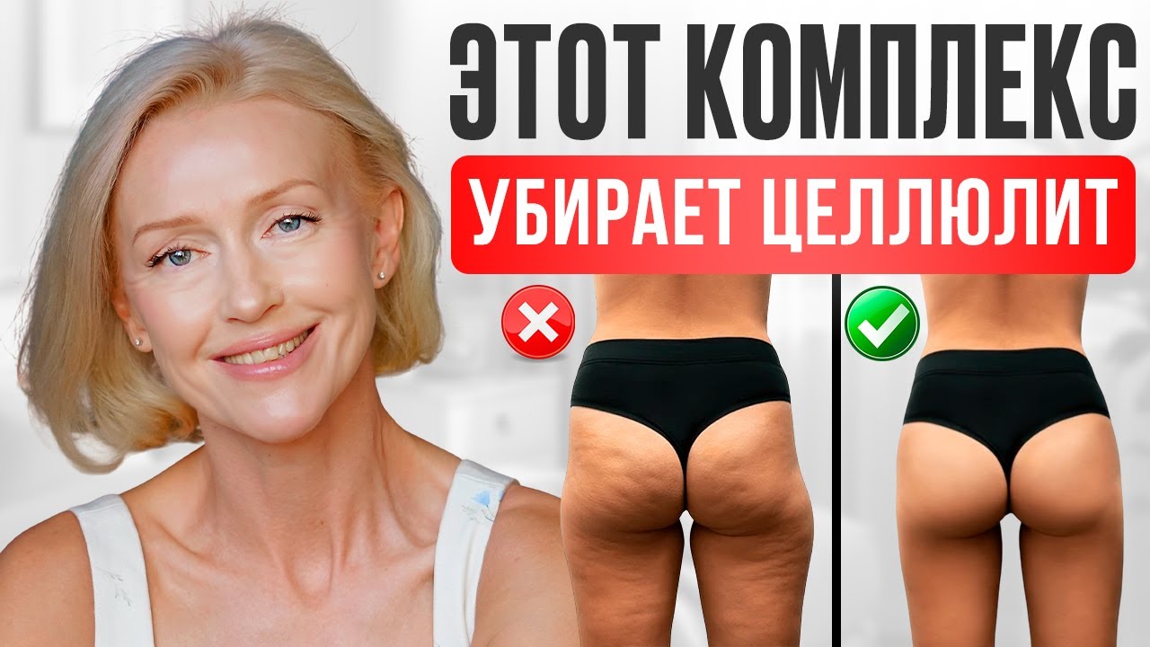 Как Убрать Целлюлит Дома После 40 Лет
