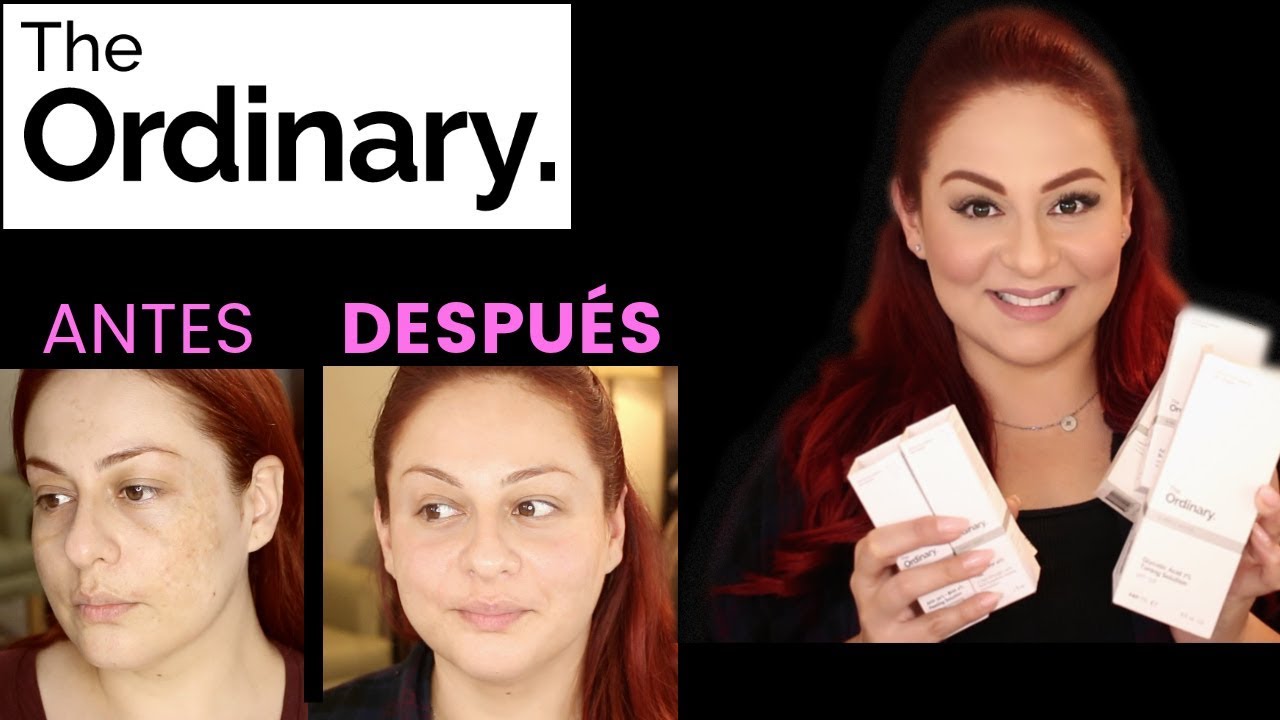 Mis Resultados con THE ORDINARY * Piel Sin Manchas 😍Productos ECONÓMICOS