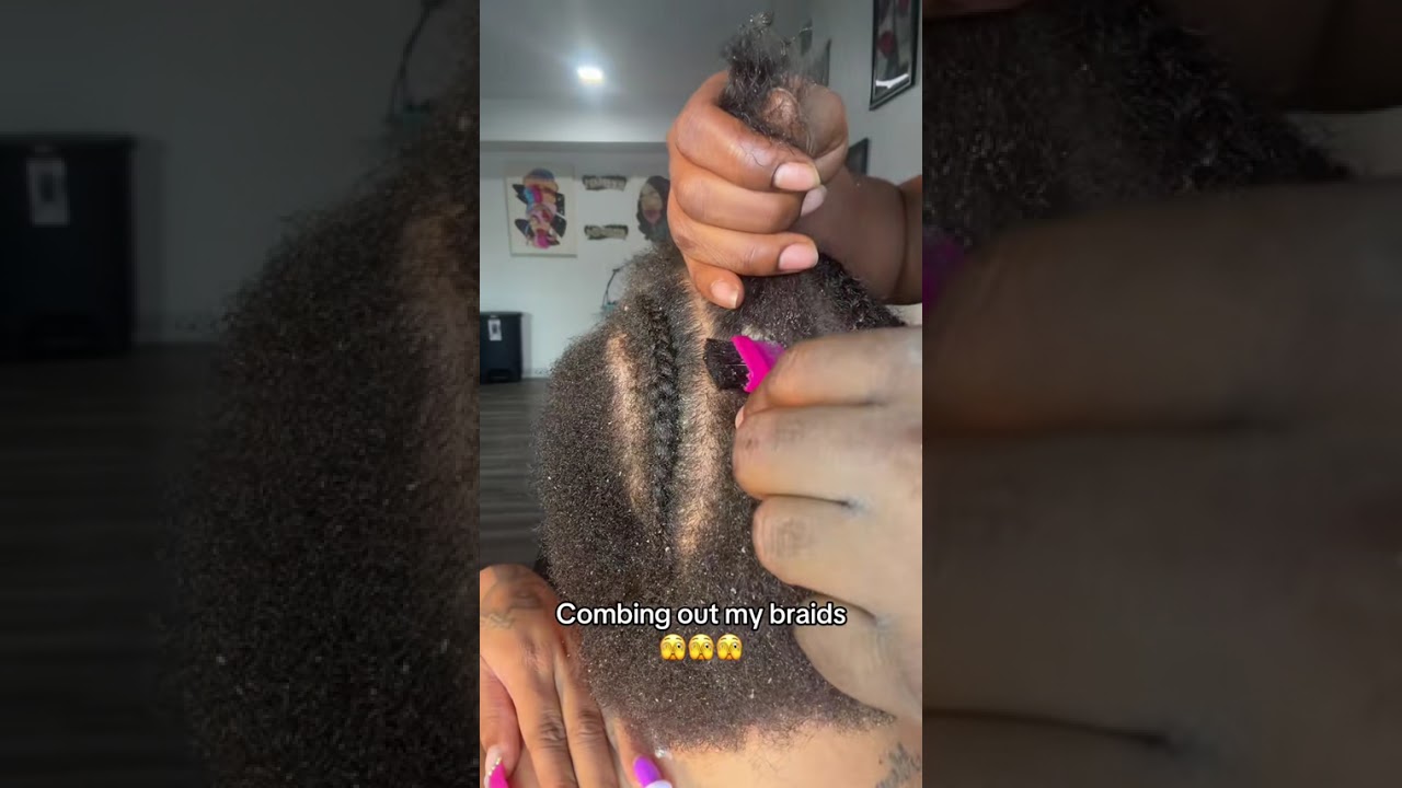 Living with scalp psoriasis 😢 #haircare #viral 