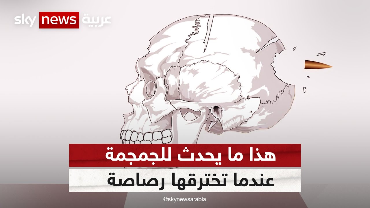 هذا ما يحدث للجمجمة عندما تخترقها رصاصة | #وثائقيات_خاصة