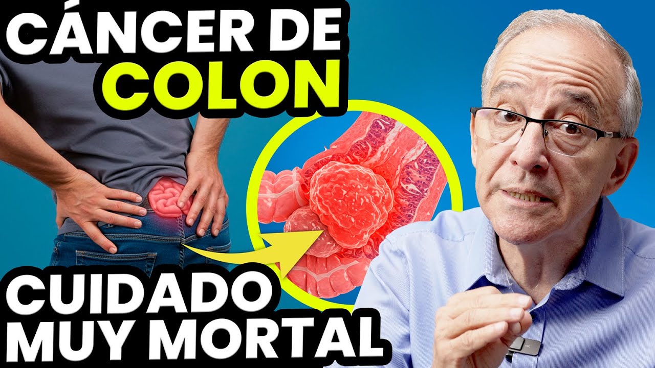 SI SIENTES ESTO TIENES CANCER DE COLON, Sintomas Del Cancer De Colon - Oswaldo Restrepo RSC