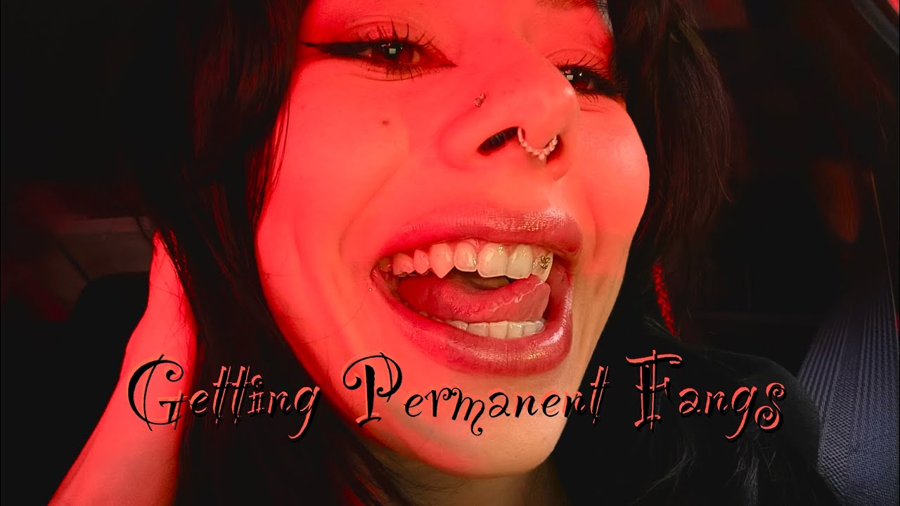 Getting Permanent Fangs by ViperVeneers 