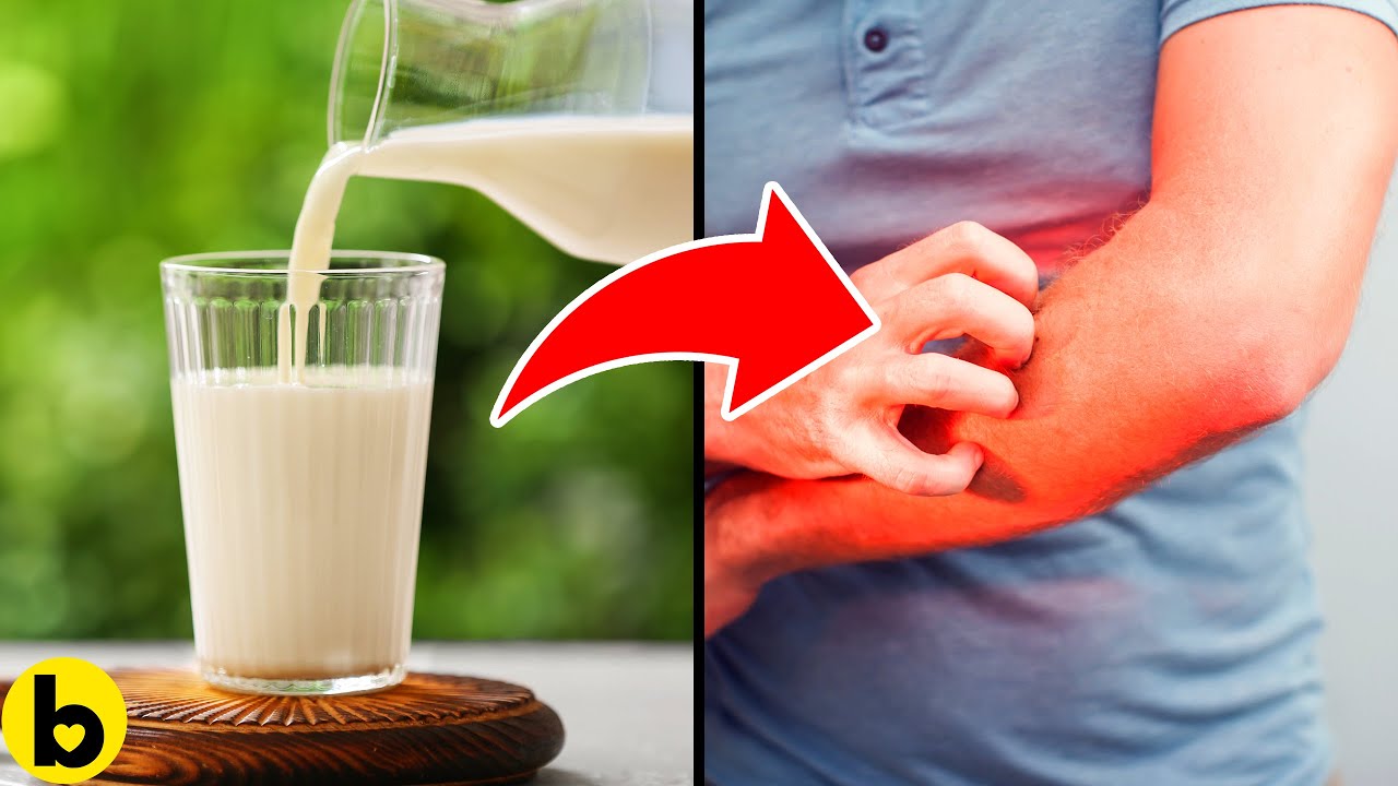 13 Common Foods That Can Make Your Skin Itch