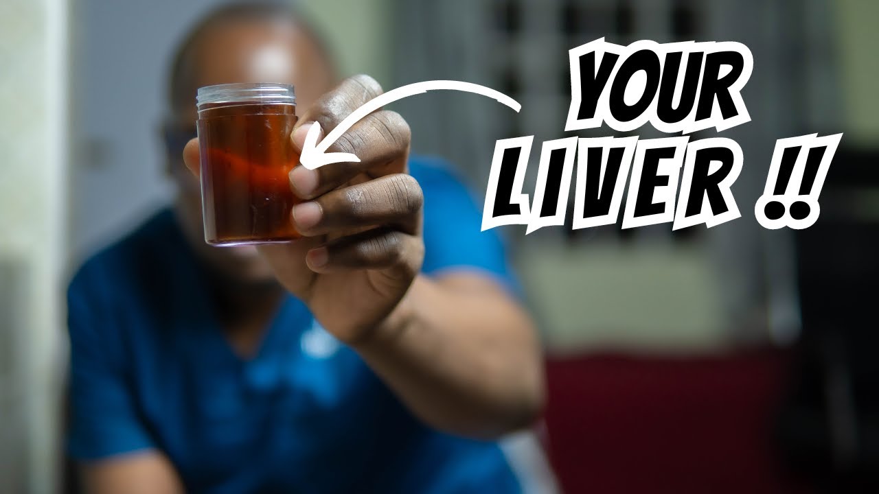 What your Urine says about your Health