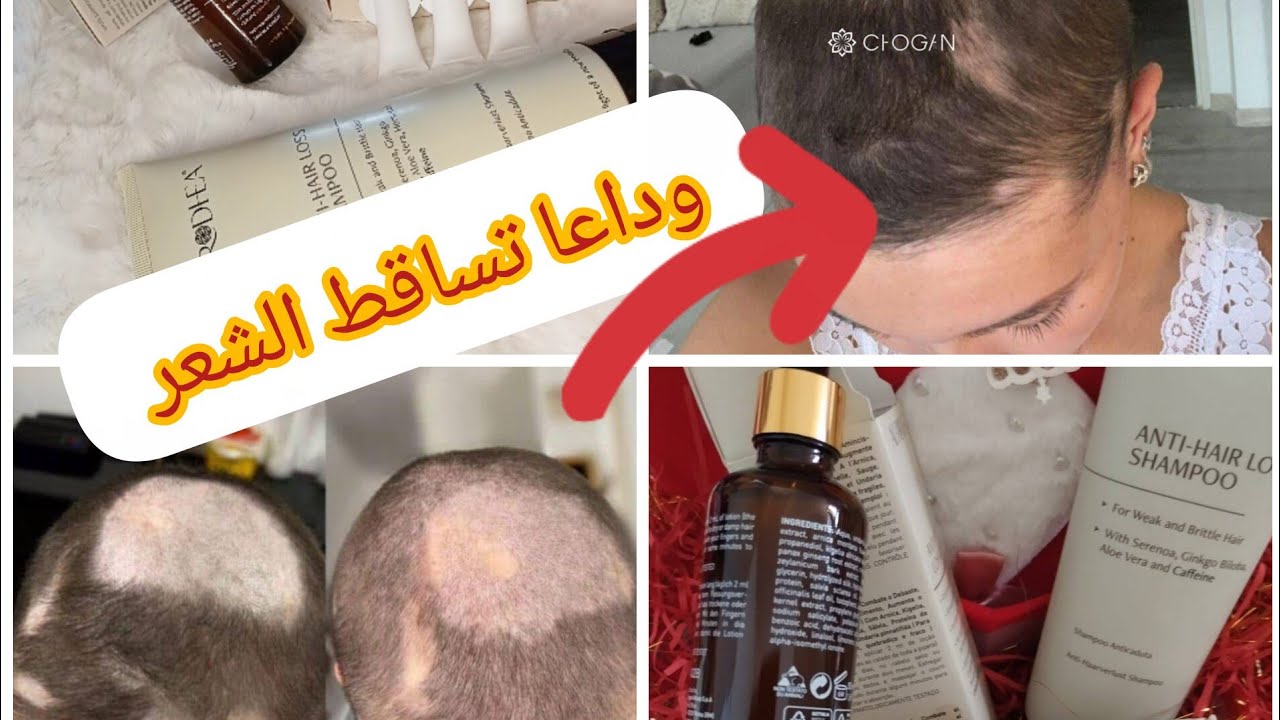 أفضل منتج ايطالي  طبيعي جربته يقضي على تساقط الشعر ويملا الفراغات ويقوي الشعر.