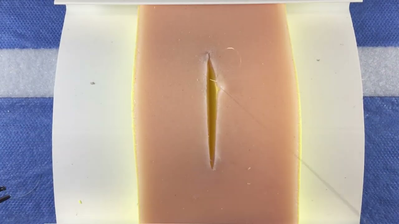 Subcuticular Suture