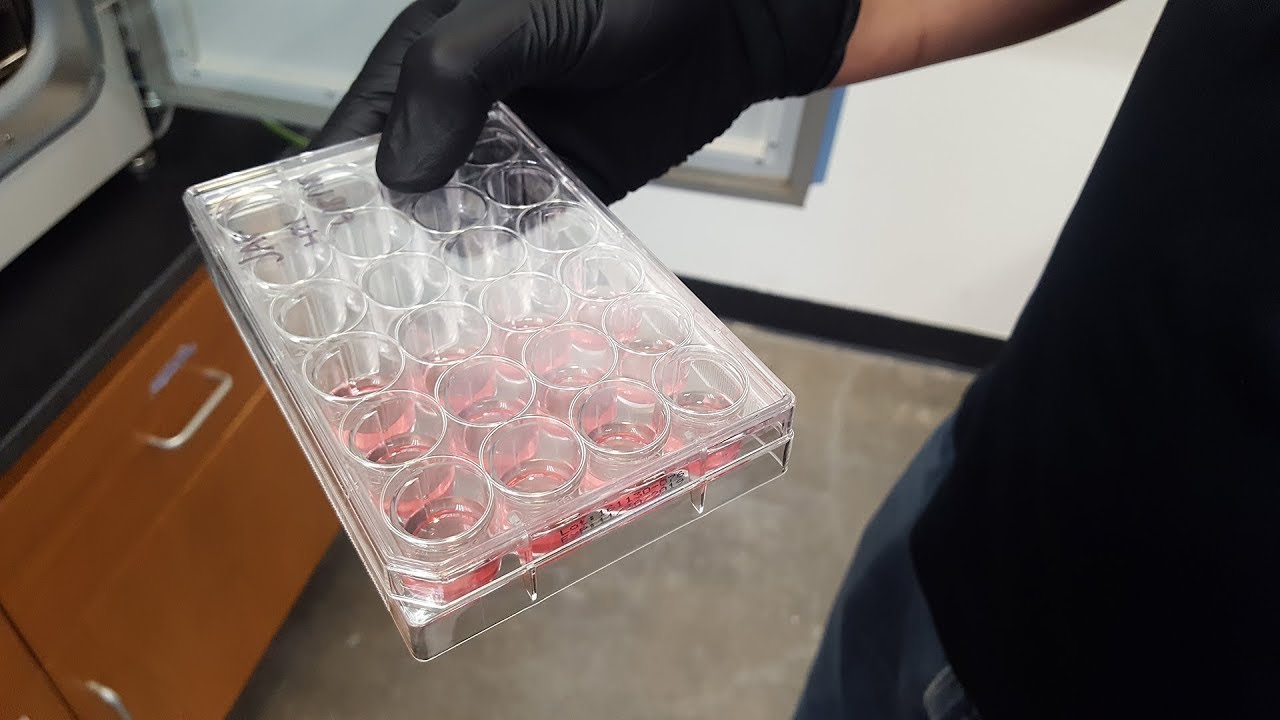 Treating Cancer Cells and Immune Issues with Cannabis Chemicals