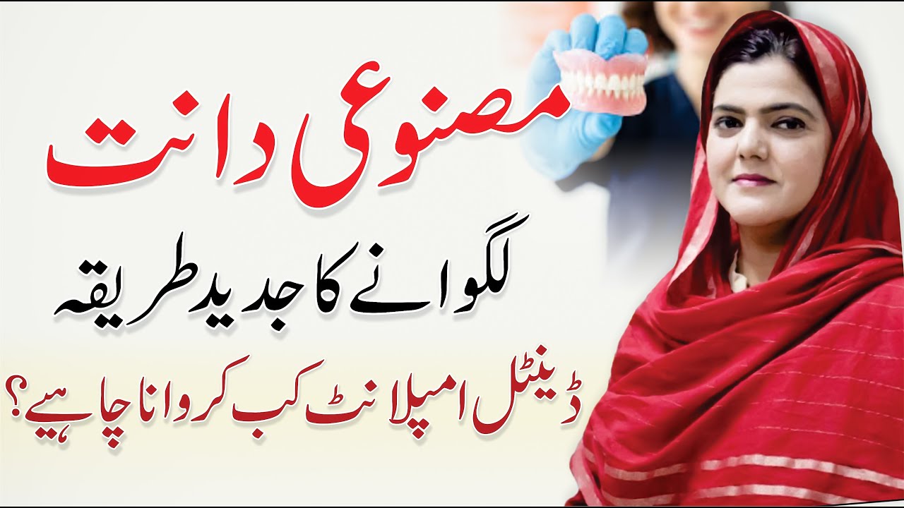 Dental Implants Procedure - Dant Lagane Ka Tarika - Dental Implant Cost | Dr. Asifa Iqbal