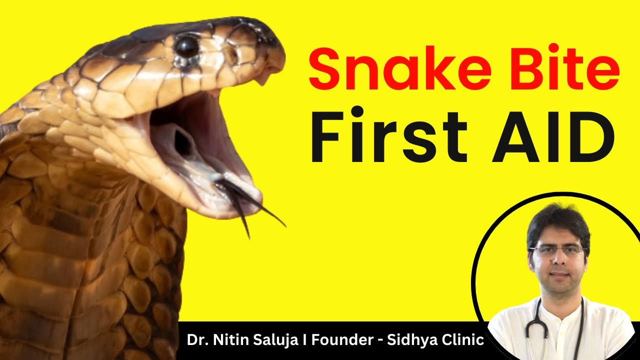 What to do when snake bites? | Snake Bite First Aid I Dr Nitin Saluja