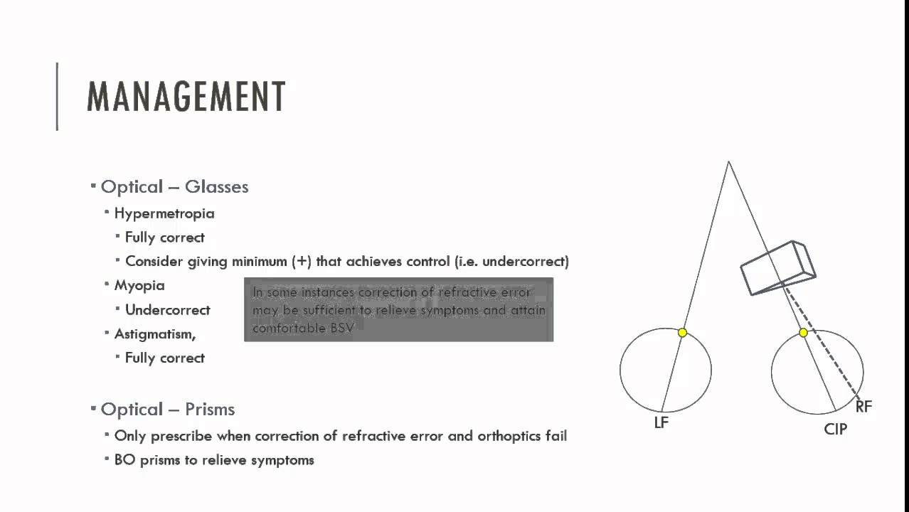 Esophoria Management