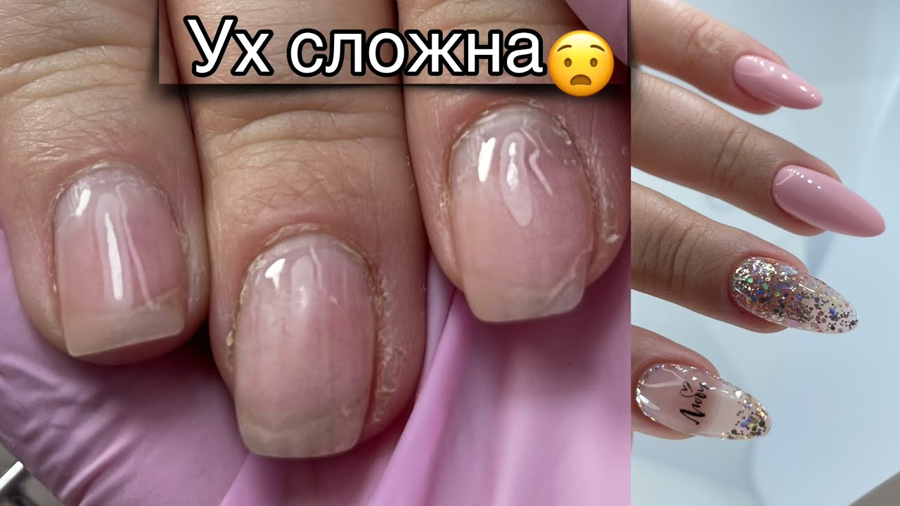Уж сложна🥱как нарастить искривлённый ноготь 😲