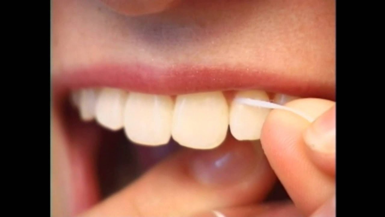 Proper Flossing Techniques | Lake Merritt Dental, Oakland, CA