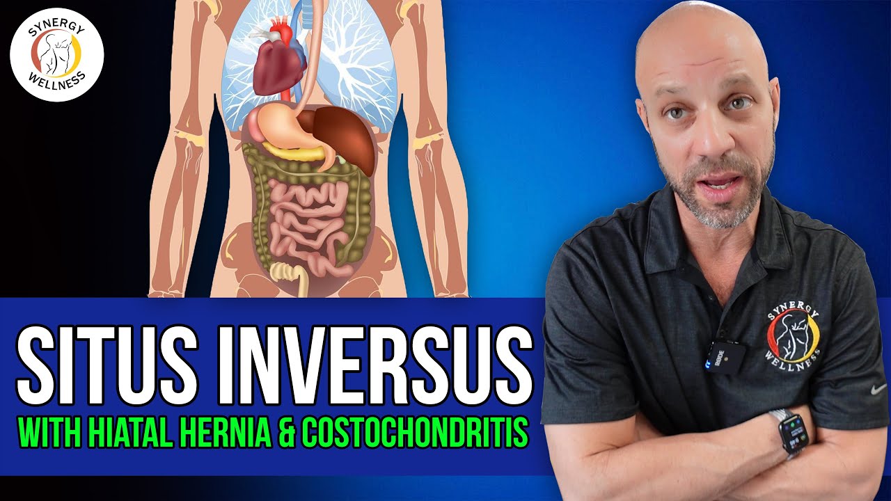 Situs Inversus with Hiatal Hernia & Costochondritis