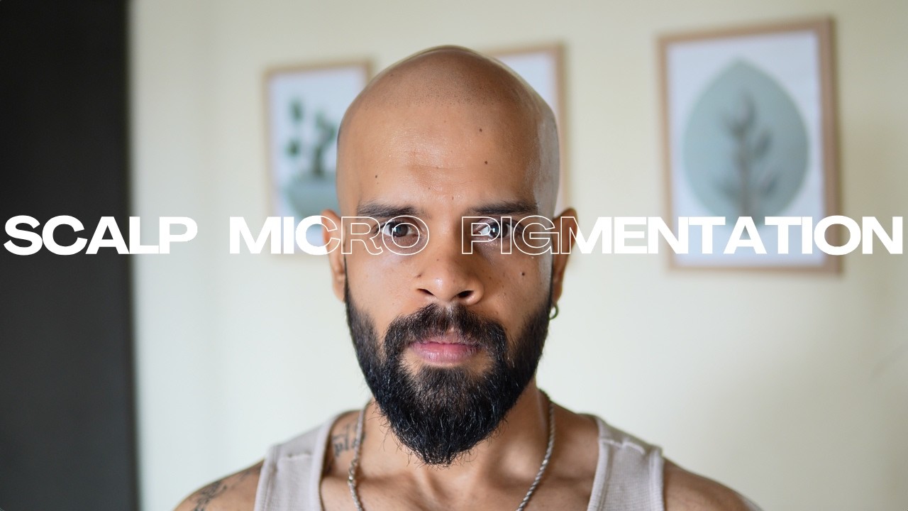 I Got Scalp Micropigmentation (SMP)! Session 1 Experience & Process | TrainWithVish
