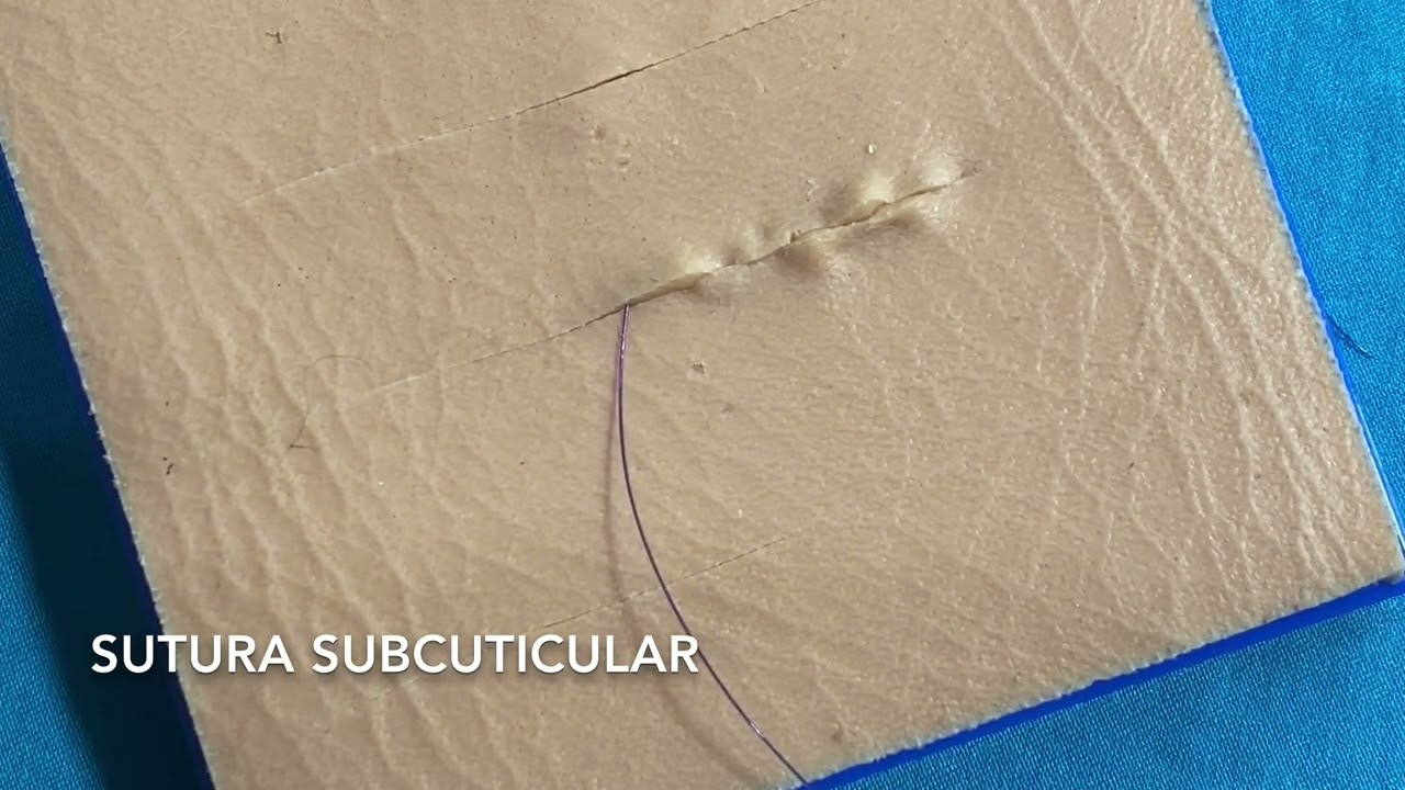 Sutura Subcuticular