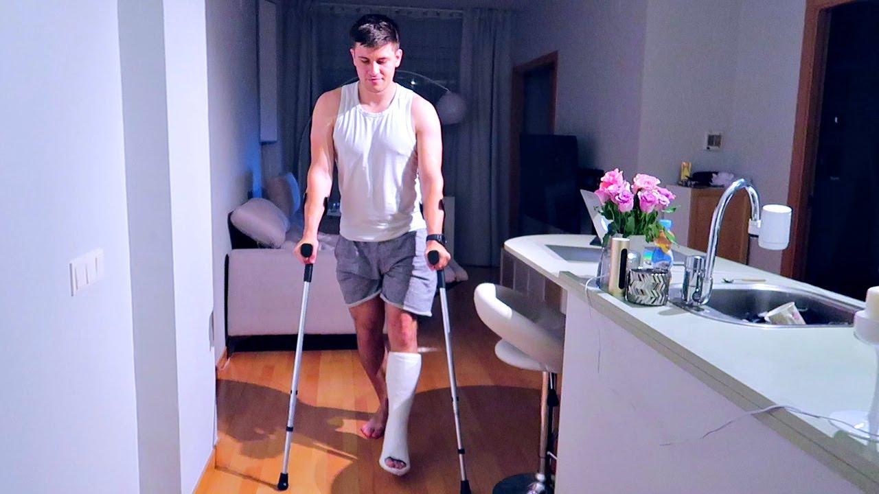 VLOG: ОЧНУЛСЯ-ГИПС! 08.06.17