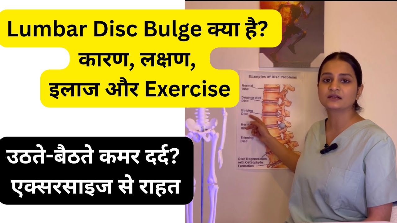 Lumbar Disc Bulge के लिए Best Exercises कमर दर्द का असली कारण 
