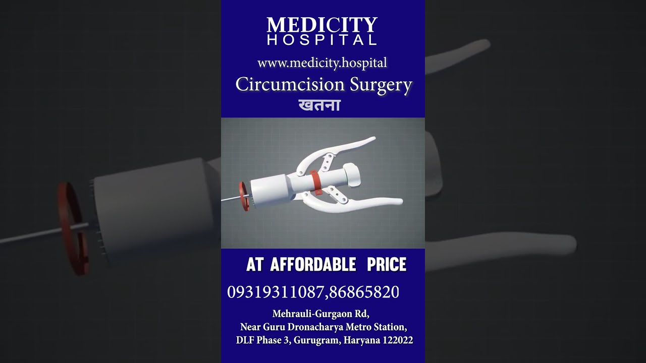 The Benefits of ZSR Circumcision Surgery: A Life-Changer! 💪 #Stapler #Circumcision #ZSRCircumcision