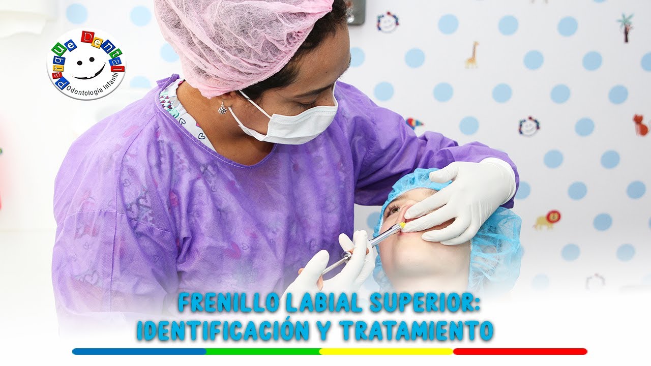 Frenillo labial superior: identificación y tratamiento