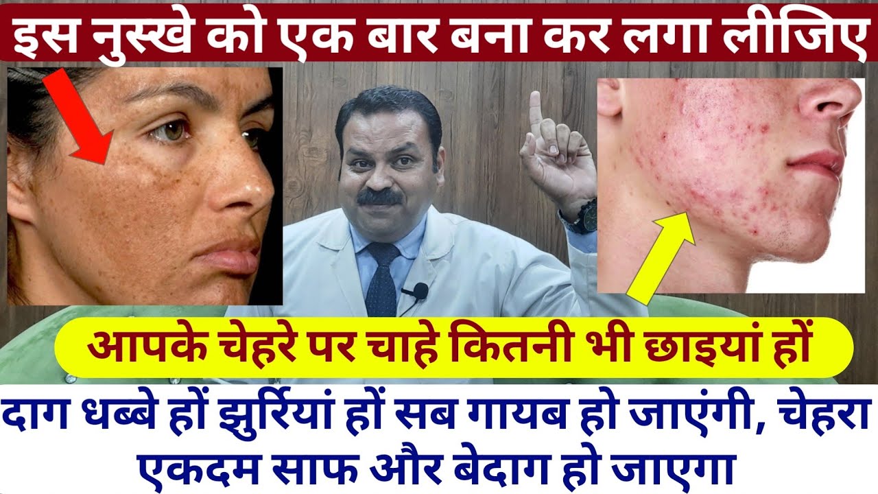 चेहरे पर चाहे कितनी भी छाइयां हों दाग धब्बे हों झुर्रियां हों सब गायब हो जाएंगी, इस को लगाने से